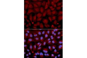 Immunofluorescence analysis of U2OS cell using BCHE antibody. (Butyrylcholinesterase anticorps  (AA 29-270))
