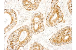 anti-MAP-Kinase Activating Death Domain (MADD) (AA 1597-1647) antibody