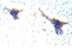 Immunohistochemistry (IHC) analyzes of PKD1/PKC-mu antibody in paraffin-embedded human brain tissue. (PKC mu anticorps)