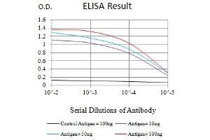 Black line: Control Antigen (100 ng),Purple line: Antigen (10 ng), Blue line: Antigen (50 ng), Red line:Antigen (100 ng)