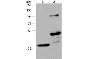 Western Blot analysis of Human fetal brain and Mouse brain tissue using GAS7 Polyclonal Antibody at dilution of 1:625 (GAS7 anticorps)