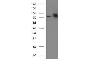 Western Blotting (WB) image for anti-Hydroxysteroid (17-Beta) Dehydrogenase 4 (HSD17B4) antibody (ABIN2715563) (HSD17B4 anticorps)