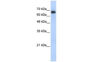 WB Suggested Anti-ZSCAN12 Antibody Titration:  0. (ZSCAN12 anticorps  (Middle Region))