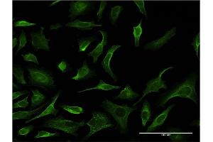 Immunofluorescence of monoclonal antibody to PHKG2 on HeLa cell.