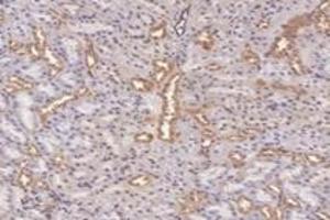 Immunohistochemistry analysis of paraffin-embedded rat kidney using,PFDN4 (ABIN7075171) at dilution of 1: 4200 (PFDN4 anticorps)