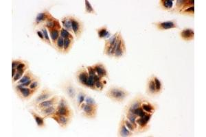 ICC testing of Ovalbumin antibody and MCF-7 cells