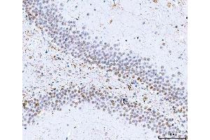 IHC analysis of HnRNP H/HNRNPH1 using anti-HnRNP H/HNRNPH1 antibody (ABIN4886623). (HNRNPH1 anticorps  (N-Term))