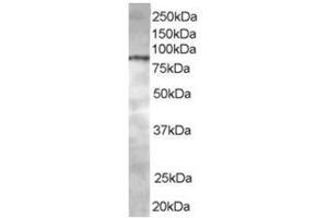 Image no. 1 for anti-ArfGAP with Coiled-Coil, Ankyrin Repeat and PH Domains 1 (ACAP1) (C-Term) antibody (ABIN374366) (ACAP1 anticorps  (C-Term))