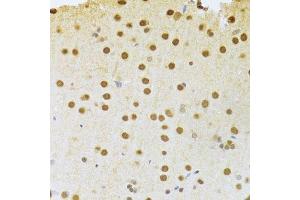 Immunohistochemistry of paraffin-embedded rat brain using ANP32A Antibody.