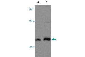 Western blot analysis of MLST8 in human brain tissue lysate with MLST8 polyclonal antibody  at (A) 1 and (B) 2 ug/mL .