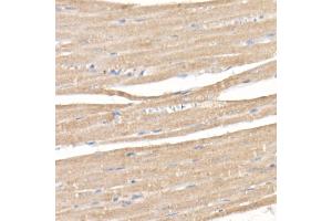 Immunohistochemistry of paraffin-embedded rat heart using SARA Rabbit mAb (ABIN7271559) at dilution of 1:50 (40x lens). (ZFYVE9 anticorps)