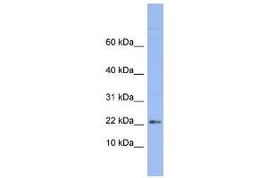 WB Suggested Anti-RPS24  Antibody Titration: 0. (RPS24 anticorps  (Middle Region))