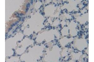 Detection of PLA2R1 in Mouse Lung Tissue using Polyclonal Antibody to Phospholipase A2 Receptor 1 (PLA2R1) (PLA2R1 anticorps  (AA 1418-1487))