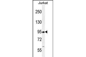 RSBN1 Antibody (N-term) (ABIN655484 and ABIN2845005) western blot analysis in Jurkat cell line lysates (35 μg/lane). (RSBN1 anticorps  (N-Term))