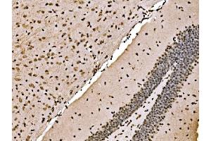 IHC analysis of SPHK1 using anti-SPHK1 antibody (ABIN7600168).