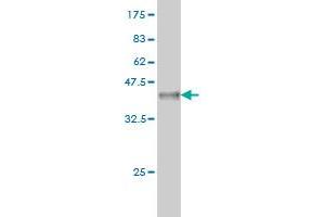 Western Blot detection against Immunogen (37.