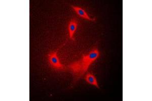 Immunofluorescent analysis of PPP2R1B staining in Raw264. (PPP2R1B anticorps  (C-Term))