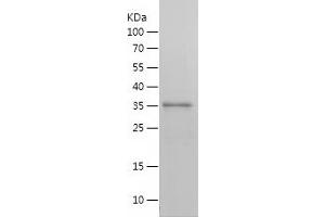 Western Blotting (WB) image for Lysine (K)-Specific Demethylase 2A (KDM2A) (AA 369-649) protein (His tag) (ABIN7123806) (KDM2A Protein (AA 369-649) (His tag))