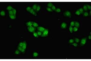 Immunofluorescent analysis of PC-3 cells using ABIN7156239 at dilution of 1:100 and Alexa Fluor 488-congugated AffiniPure Goat Anti-Rabbit IgG(H+L) (INHBB anticorps  (AA 295-405))