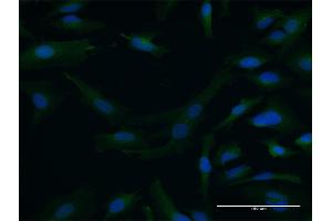 Immunofluorescence of purified MaxPab antibody to DTNA on HeLa cell. (DTNA anticorps  (AA 1-371))