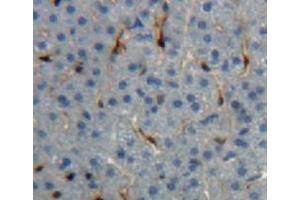 Used in DAB staining on fromalin fixed paraffin-embedded liver tissue (IGF1 anticorps  (AA 33-102))
