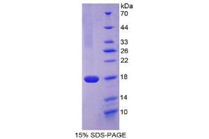 SDS-PAGE (SDS) image for CD99 (CD99) (AA 26-160) protein (His tag) (ABIN1980937)