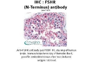 Image no. 1 for anti-Follicle Stimulating Hormone Receptor (FSHR) (Extracellular Domain), (N-Term) antibody (ABIN1734473) (FSHR anticorps  (Extracellular Domain, N-Term))