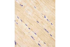 (ABIN652609 and ABIN2842407) staining RAB7 in human skeletal muscle tissue sections by Immunohistochemistry (IHC-P - paraformaldehyde-fixed, paraffin-embedded sections). (RAB7A anticorps  (C-Term))