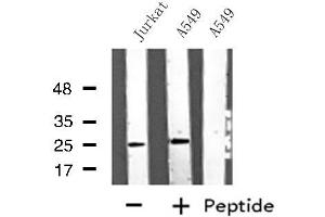 Western blot analysis of extracts from A549/Jurkat cells, using ARHGDIG antibody. (ARHGDIG anticorps  (Internal Region))