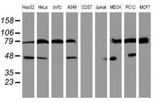 Image no. 9 for anti-serpin Peptidase Inhibitor, Clade B (Ovalbumin), Member 1 (SERPINB1) (AA 77-306) antibody (ABIN1491671)