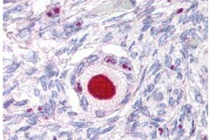 Immunohistochemistry (Formalin/PFA-fixed paraffin-embedded sections) of human ovary tissue with NR5A1 polyclonal antibody . (NR5A1 anticorps  (Internal Region))
