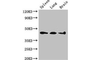 Western Blot Positive WB detected in: Mouse spleen tissue, Mouse lung tissue, Mouse brain tissue All lanes: NCF1 antibody at 3 μg/mL Secondary Goat polyclonal to rabbit IgG at 1/50000 dilution Predicted band size: 45, 31 kDa Observed band size: 45 kDa