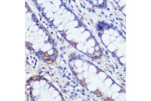 Immunohistochemistry of paraffin-embedded Human colon using CF Rabbit pAb (ABIN7266399) at dilution of 1:100 (40x lens). (CFAP61 anticorps)