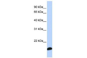 PRDX5 antibody used at 1 ug/ml to detect target protein. (Peroxiredoxin 5 anticorps  (Middle Region))