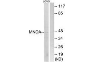 Western Blotting (WB) image for anti-Myeloid Cell Nuclear Differentiation Antigen (MNDA) (AA 358-407) antibody (ABIN2890426) (MNDA anticorps  (AA 358-407))