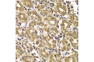 Immunohistochemistry of paraffin-embedded human gastric using HSPE1 antibody at dilution of 1:100 (x400 lens). (HSPE1 anticorps)