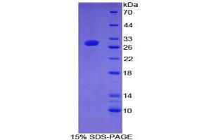 SDS-PAGE analysis of Mouse Coagulation Factor XII Protein. (F12 Protéine)