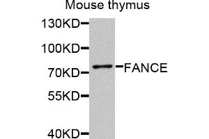 Western blot analysis of extracts of mouse thymus, using FANCE antibody.