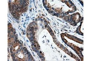 Immunohistochemical staining of paraffin-embedded Kidney tissue using anti-IFT57mouse monoclonal antibody. (IFT57 anticorps)