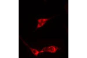 ABIN6275347 staining  HeLa cells by IF/ICC. (PEX3 anticorps  (N-Term))