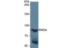 Detection of HIF1a in Human Serum using Polyclonal Antibody to Hypoxia Inducible Factor 1 Alpha (HIF1a) (HIF1A anticorps  (AA 218-506))