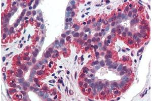 anti-Tumor Necrosis Factor (Ligand) Superfamily, Member 13 (TNFSF13) (AA 1-17) antibody