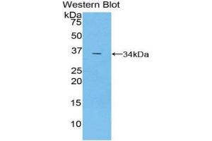 Western Blotting (WB) image for anti-TNF Receptor-Associated Factor 5 (TRAF5) (AA 181-437) antibody (ABIN1860860) (TRAF5 anticorps  (AA 181-437))