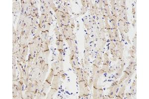 Immunohistochemistry analysis of paraffin-embedded rat heart using Connexin 43 Polyclonal Antibody at dilution of 1:300. (Connexin 43/GJA1 anticorps)