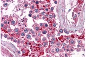 Human Testis: Formalin-Fixed, Paraffin-Embedded (FFPE) (BIRC3 anticorps  (AA 314-508))