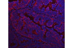IF analysis of FASN using anti-FASN antibody (ABIN3044520). (Fatty Acid Synthase anticorps  (AA 1-226))