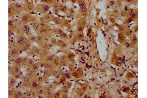 IHC image of ABIN7154041 diluted at 1:300 and staining in paraffin-embedded human liver tissue performed on a Leica BondTM system. (PET112L anticorps  (AA 301-383))