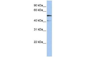 SLC23A3 antibody used at 1 ug/ml to detect target protein.
