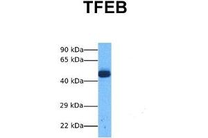 Host:  Rabbit  Target Name:  TFEB  Sample Tissue:  Human Lung Tumor  Antibody Dilution:  1. (TFEB anticorps  (Middle Region))