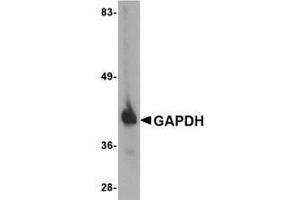 Image no. 1 for anti-Glyceraldehyde-3-Phosphate Dehydrogenase (GAPDH) (C-Term) antibody (ABIN341733) (GAPDH anticorps  (C-Term))
